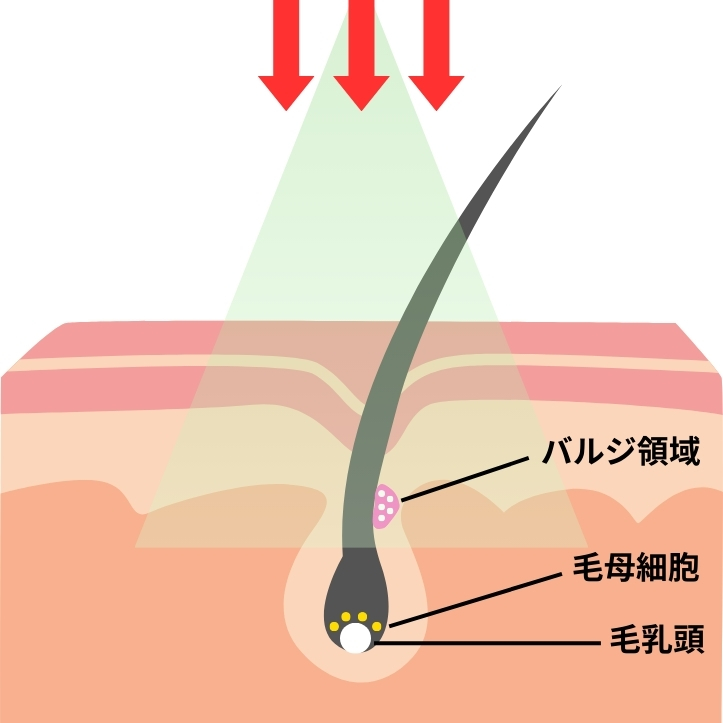 蓄熱式