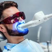 歯科医院ホワイトニング